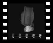 Video 4: Animation sequence comparing DVR, MIDA, and MIP applied to a CT scan